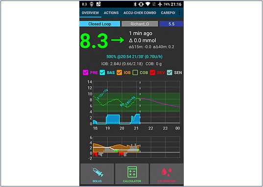 AndroidAPS программа автоматизации управления диабетом - отзыв